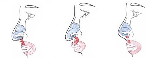 Obcięcie części mięśnia nosa