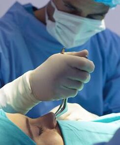 wykonując zamkniętą operację plastyczną nosa