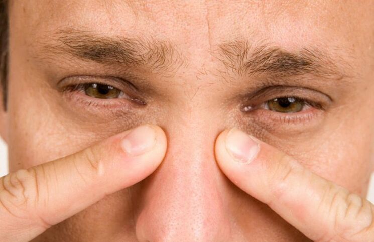 Uporczywy ból nosa jest poważnym powikłaniem plastyki nosa